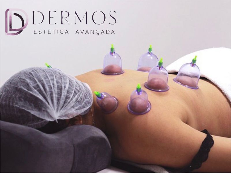 Relaxe e Revitalize: Massagem Relaxante com Ventosoterapia - Reserve Agora!